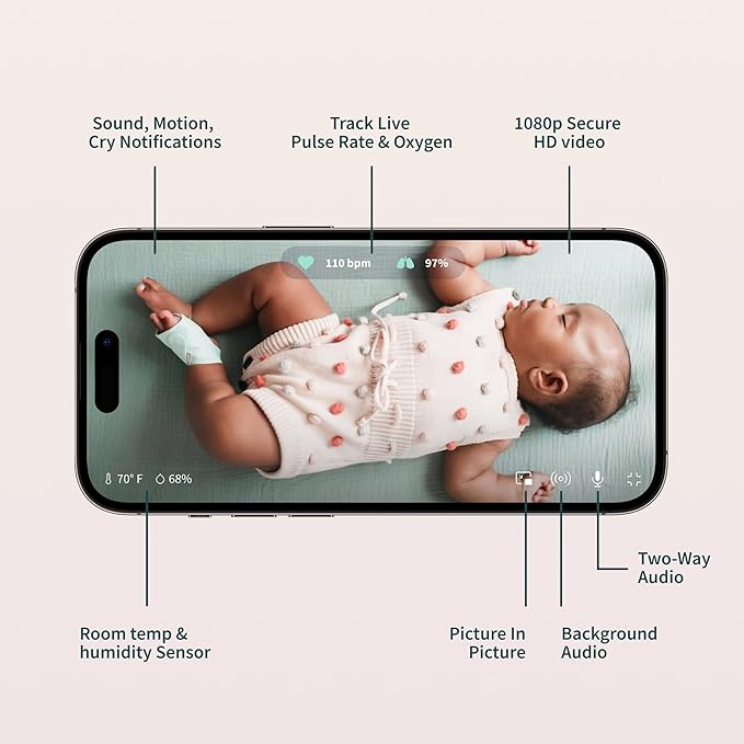 Owlet Dream Duo – FDA-Cleared Smart Baby Monitor with Sock & HD Video Cam 2K HD Video, Cry & Motion Alerts, Temp Monitoring