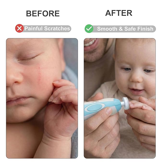 Fansidi Upgraded Baby Nail Trimmer Electric | Easy & Safe Baby Nail File, Precise 4-Stage Gentle Nail Buffer + Nail Clippers for Newborn to Toddler, with 18 Grinding Heads & Soft LED Light, Blue